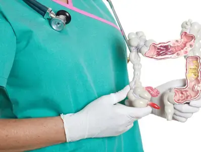 Medico con un modelo de intestino grueso