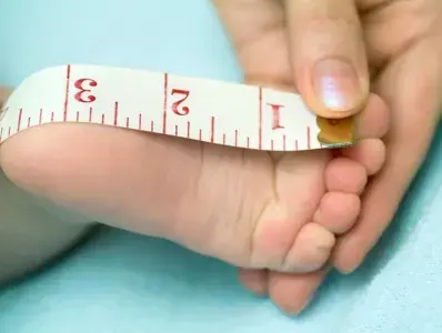 Médico realizando medición del pie del bebe.