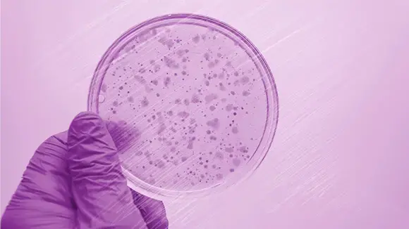 El rol de la microbiota intestinal en el sistema inmunológico El rol de la microbiota intestinal en el sistema inmunológico